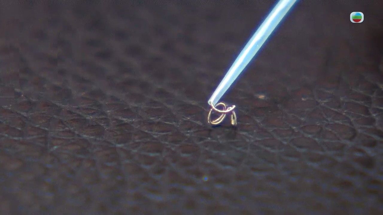 頭痛｜劇烈頭痛小心是腦血管瘤破裂！專科醫生拆解腦動脈瘤影響/檢查/手術方法