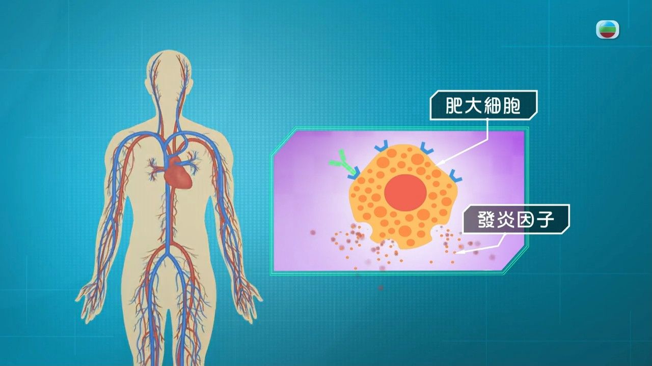 風癩｜醫生解構3種人較易患上蕁麻疹！一文睇晒蕁麻疹成因/治療方法/飲食建議