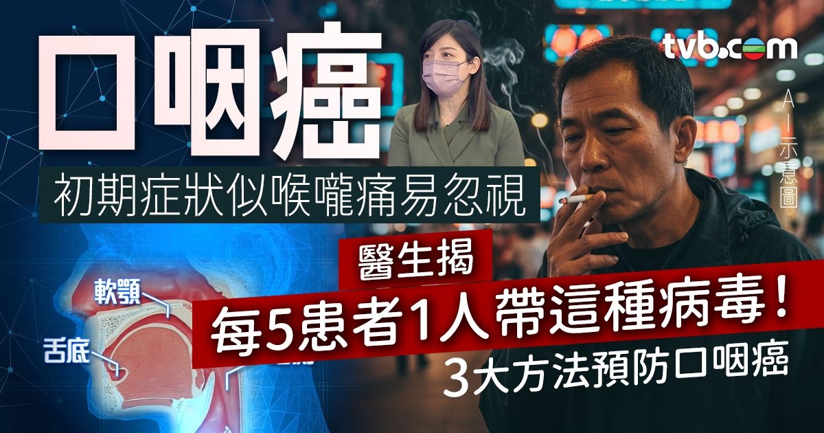 口咽癌｜初期症狀似喉嚨痛易忽視 醫生揭每5患者1人帶一種病毒！3大方法預防口咽癌 | TVB 無綫集團