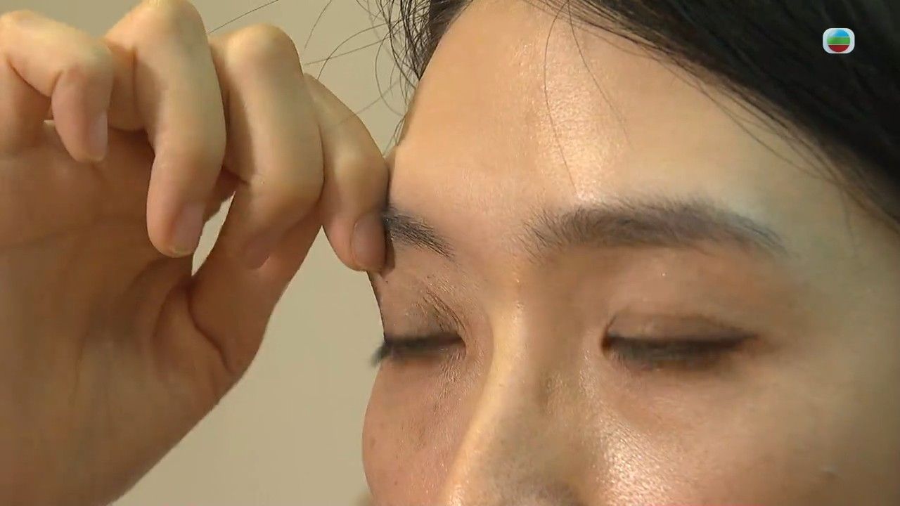 白內障｜視力模糊小心白內障！醫生警告嚴重可致2大眼疾 即睇治療方法/中醫穴位按摩