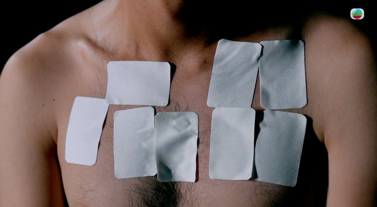 止痛貼｜亂用止痛貼隨時會死？專科醫生指一成份屬處方藥 原來不可睡覺貼膏布