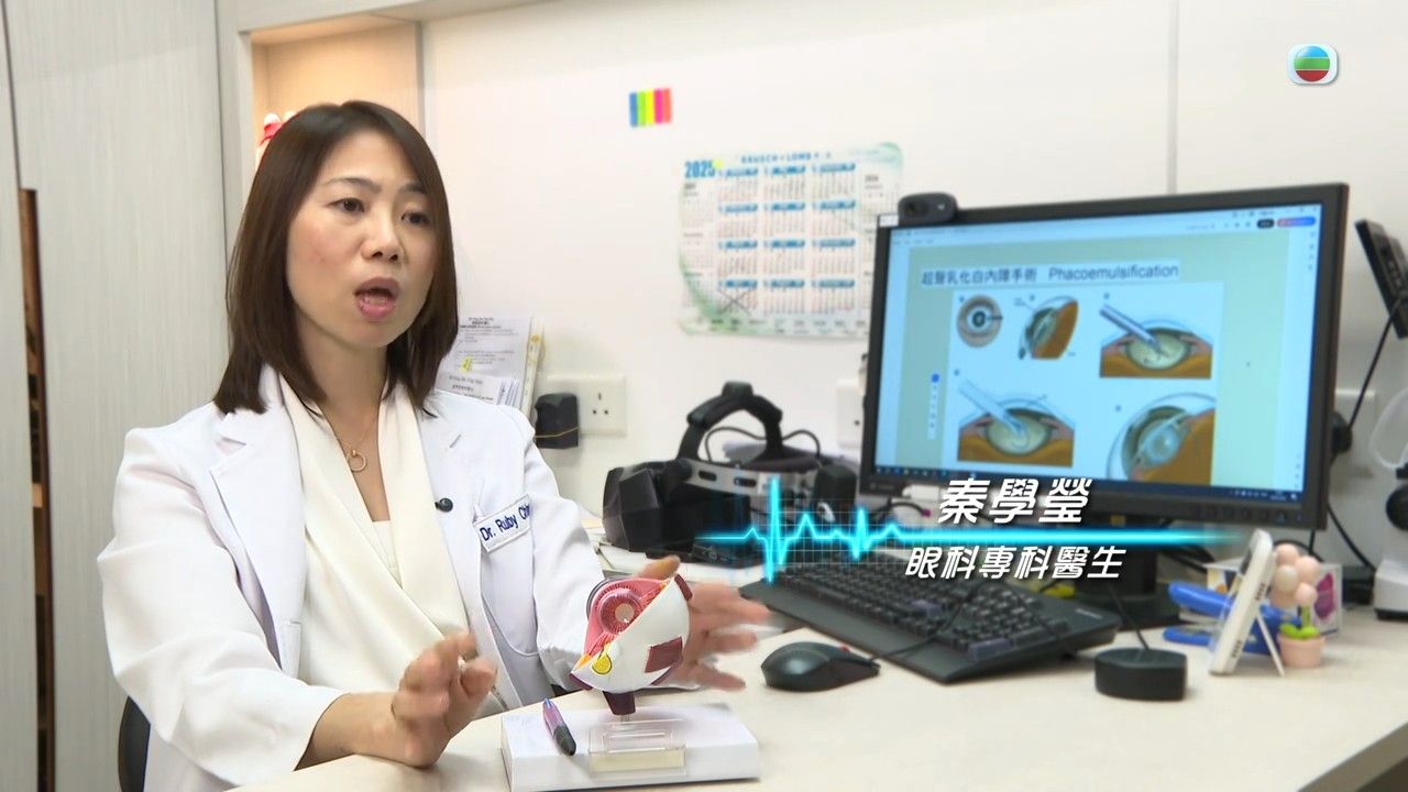 白內障｜視力模糊小心白內障！醫生警告嚴重可致2大眼疾 即睇治療方法/中醫穴位按摩