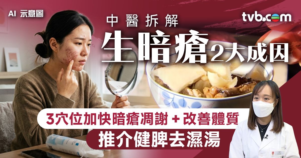生暗瘡｜中醫拆解生暗瘡2大成因 必學3穴位加快暗瘡凋謝/改善體質 推介健脾去濕湯 | TVB 無綫電視
