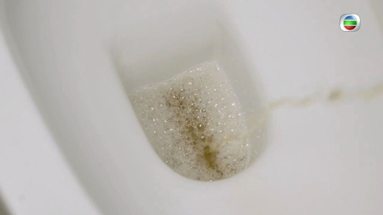 尿頻｜忍尿無益？專家拆解尿頻/夜尿問題！教3大方法＋2組運動減少夜尿