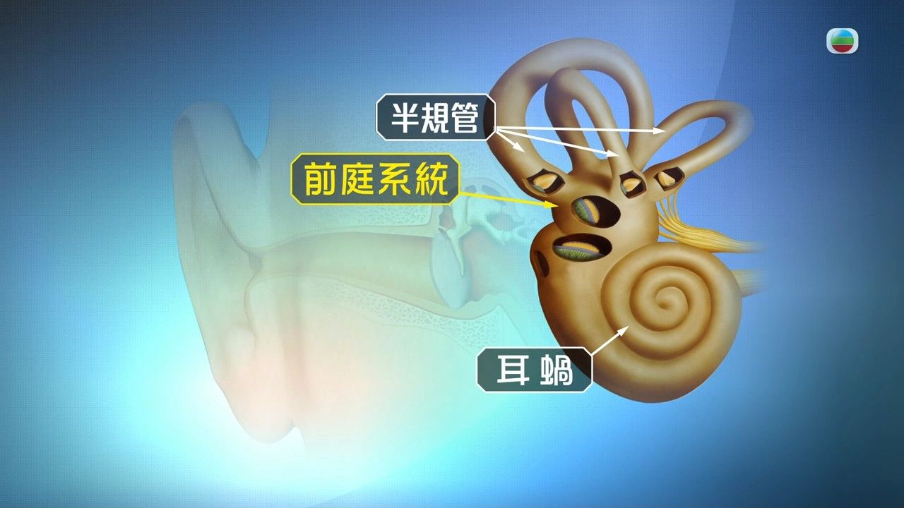 耳水不平衡｜天旋地轉頭暈是耳水不平衡造成？患者日常7大宜忌 物理治療師教1組動作改善暈眩感