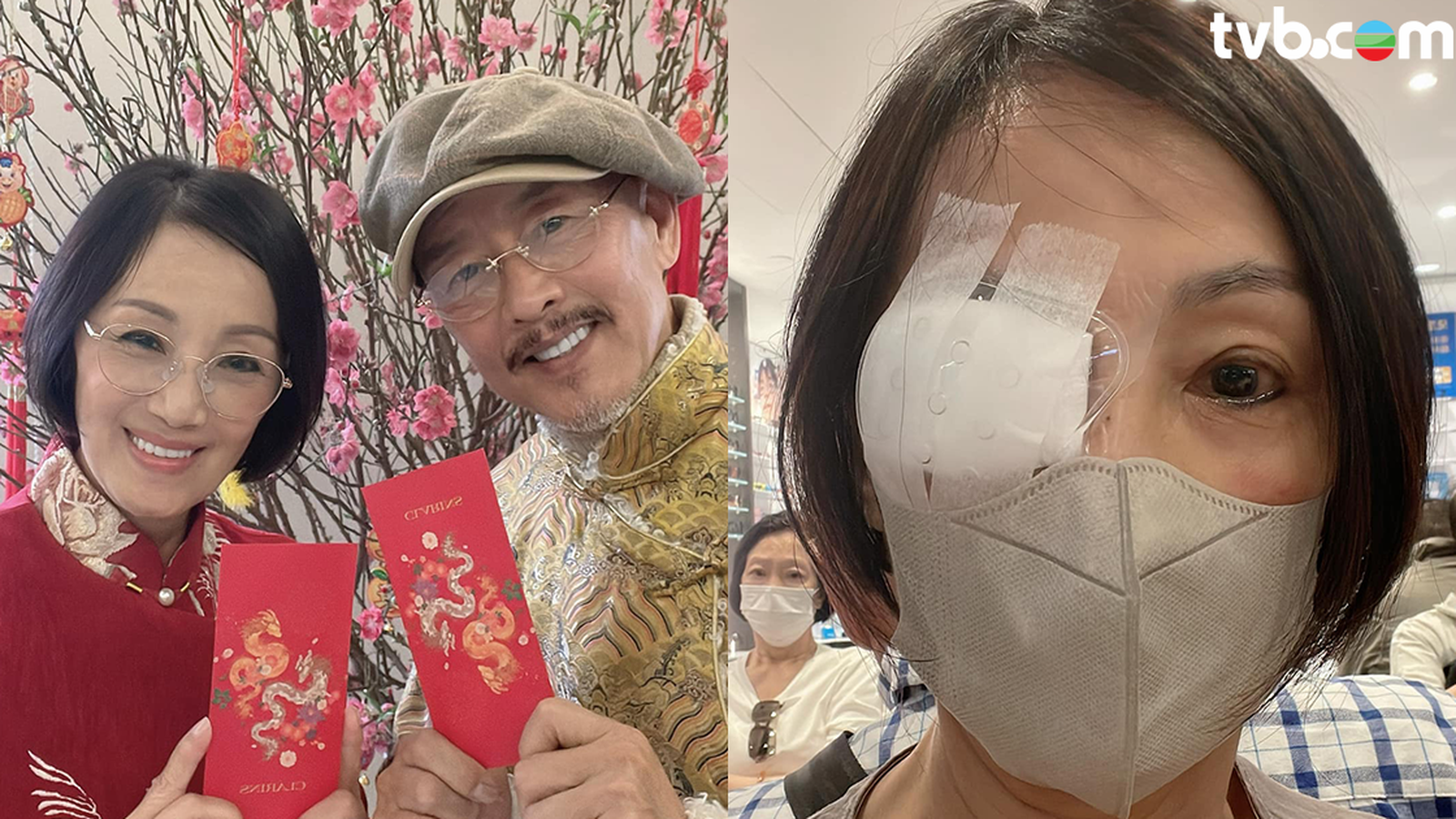 69歲韓馬利突宣佈眼部做手術身形消瘦 曾因腦膜炎險死後患情緒病 老公杜燕歌不離不棄