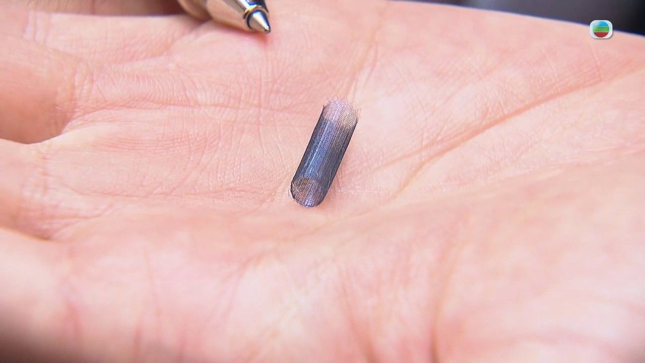 頭痛｜劇烈頭痛小心是腦血管瘤破裂！專科醫生拆解腦動脈瘤影響/檢查/手術方法