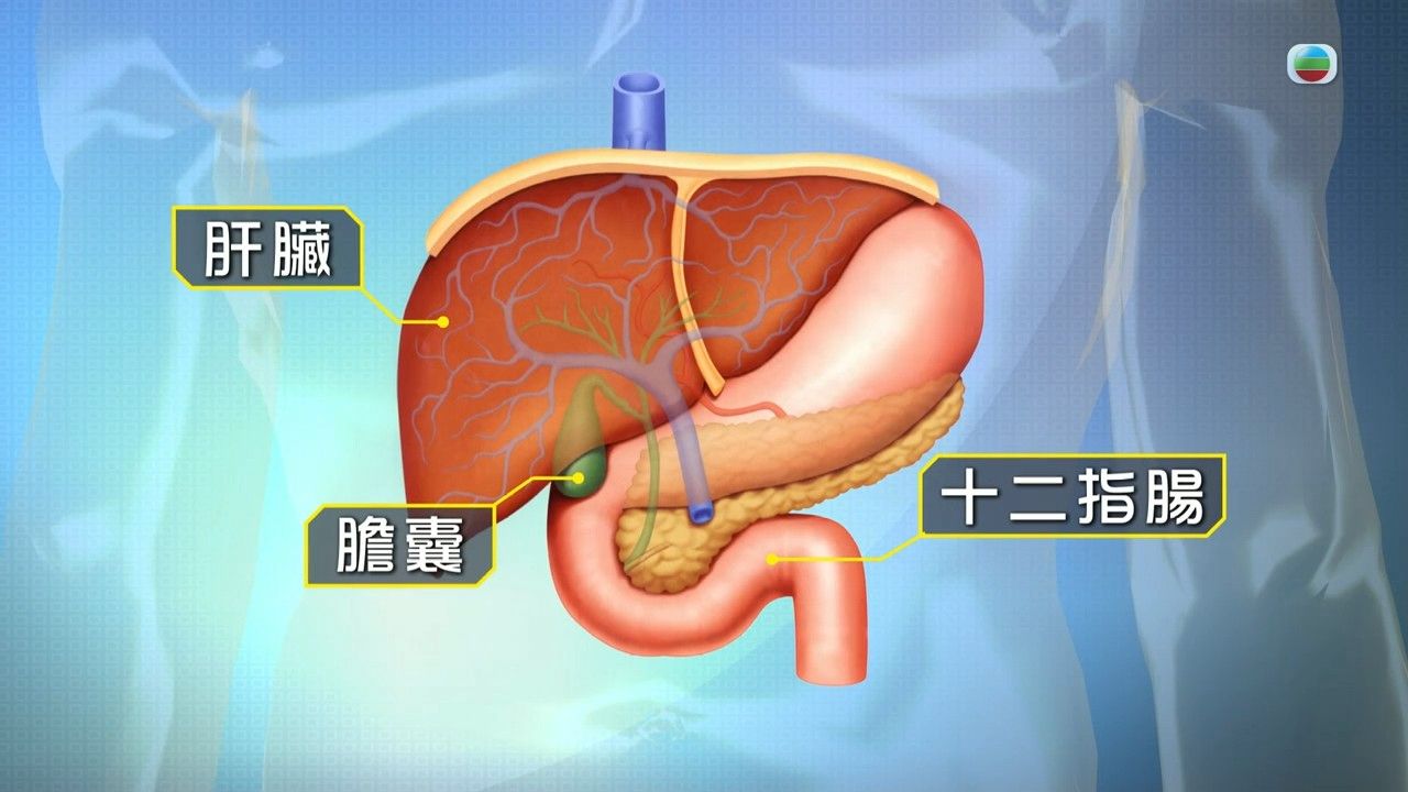 膽囊癌｜上腹不舒服小心是膽囊癌！醫生揭早期5大病徵似生膽石 即睇病因/高危人士/治療方法