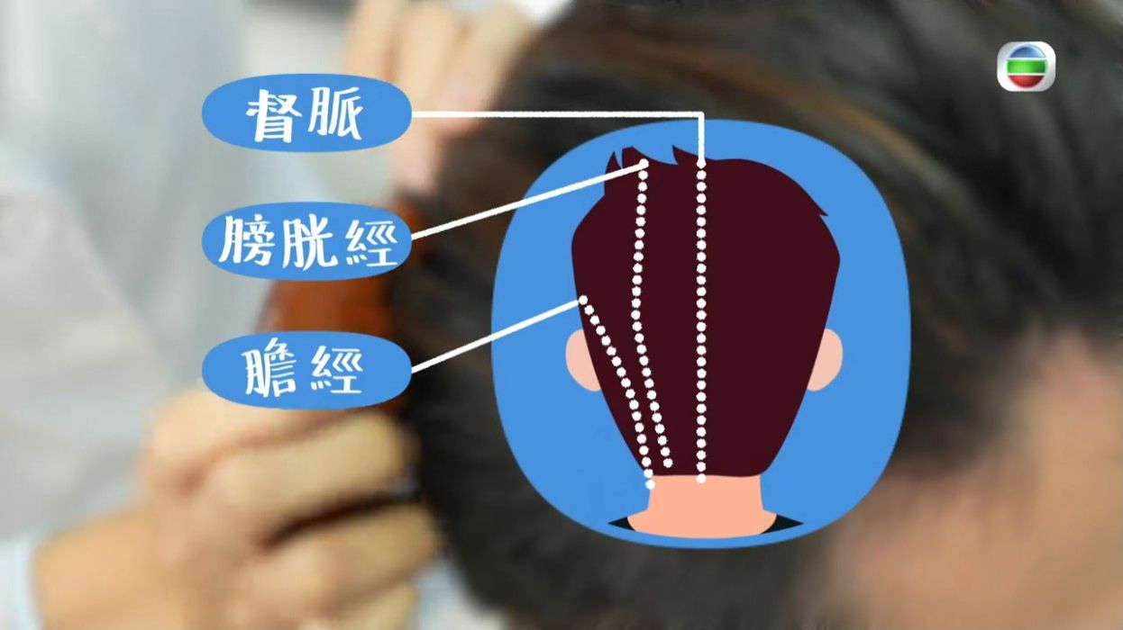 脫髮原因｜中醫教一招梳頭防脫髮防白髮！生薑捽頭生髮有根據？