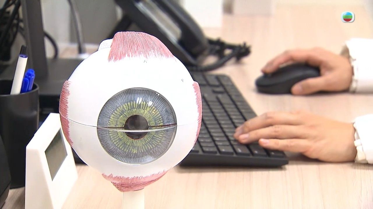 飛蚊症是視網膜脫落警號？飛蚊症3大高危人士要注意 營養師推介3類食物日常護眼