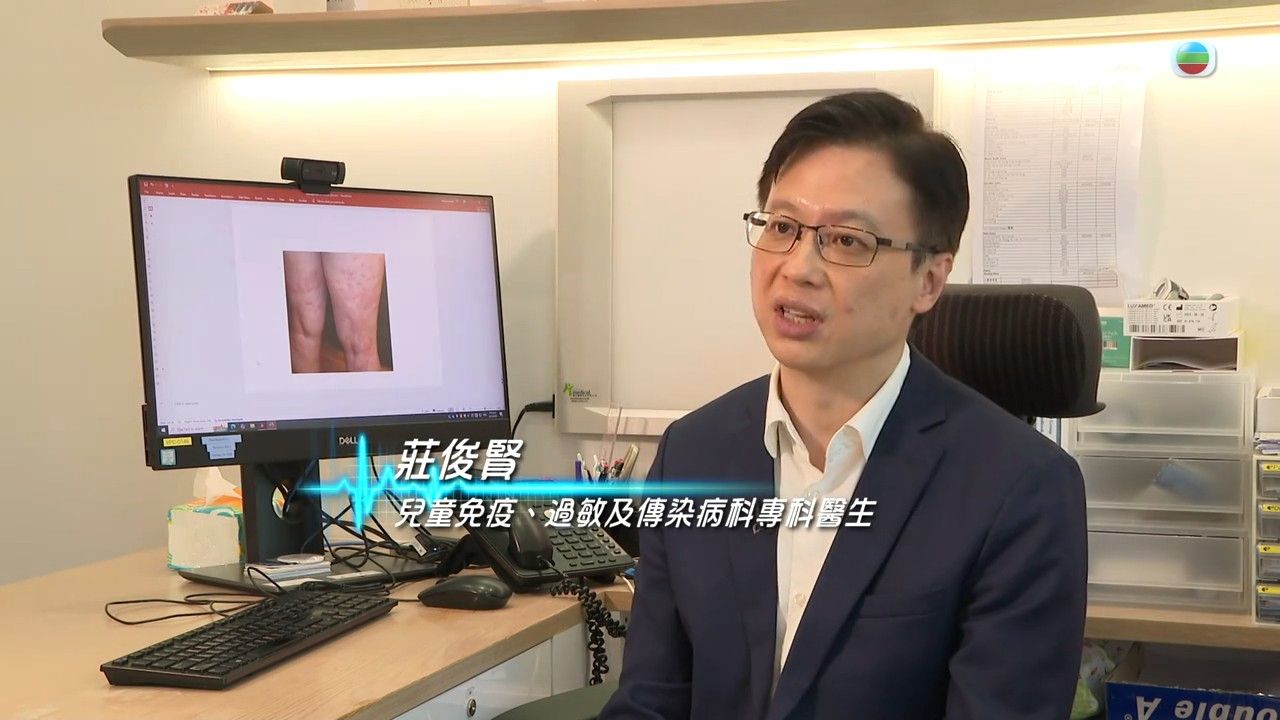 風癩｜醫生解構3種人較易患上蕁麻疹！一文睇晒蕁麻疹成因/治療方法/飲食建議
