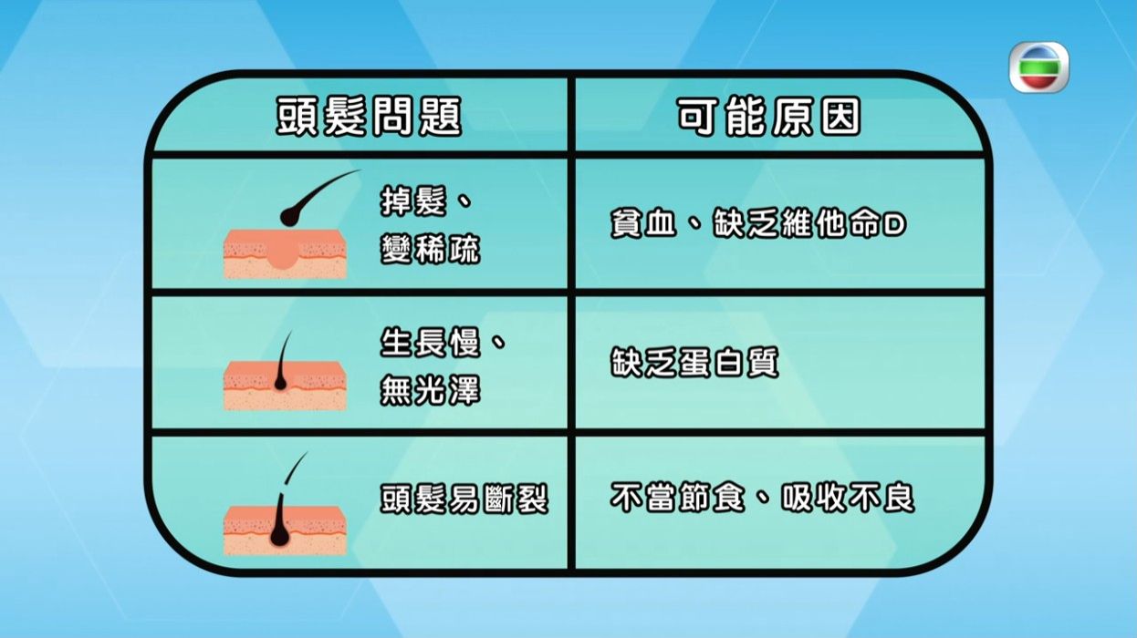 脫髮原因｜中醫教一招梳頭防脫髮防白髮！生薑捽頭生髮有根據？