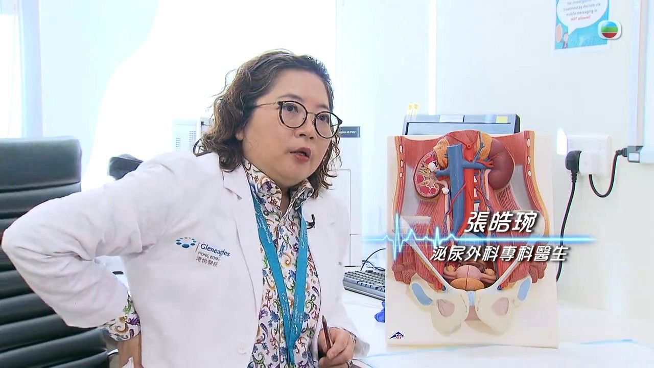 腎結石｜飲奶茶會生腎石？5種人士屬高風險 腰後痠軟要注意！推介1款茶飲利尿消腫