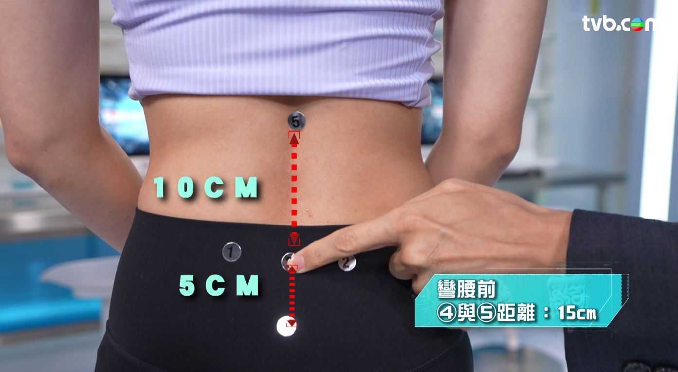 風濕病｜周杰倫患強直性脊椎炎 曾要媽媽代穿襪！專家拆解初期＋後期症狀！2大測試自我檢測