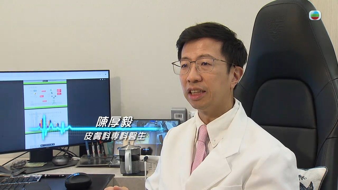 牛皮癬｜專科醫生拆解銀屑病4大成因 處理不當會變關節病！3種方法紓緩牛皮癬